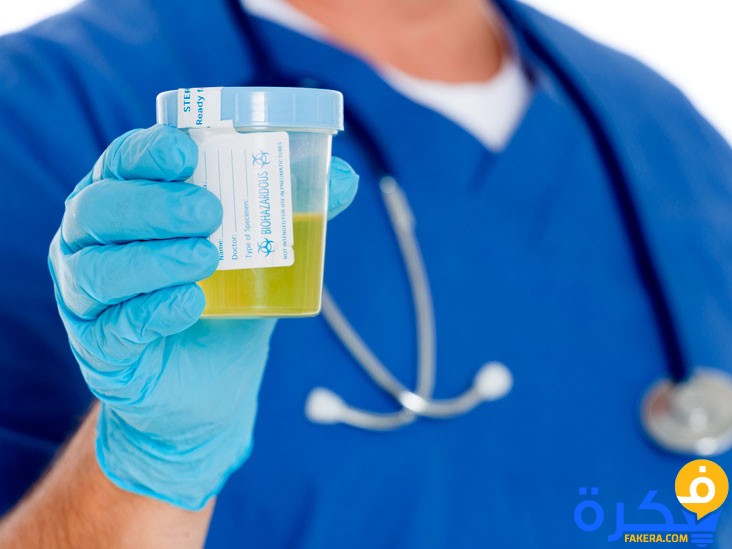 تحليل البول الكامل Complete Urine Analysis