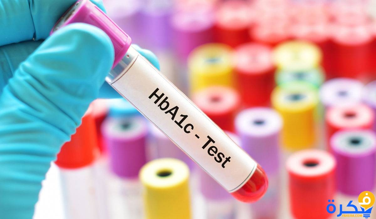 ما هي شرح خطوات تحليل السكر التراكمي