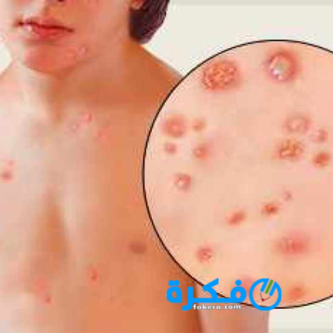 inbound5629375551588722485