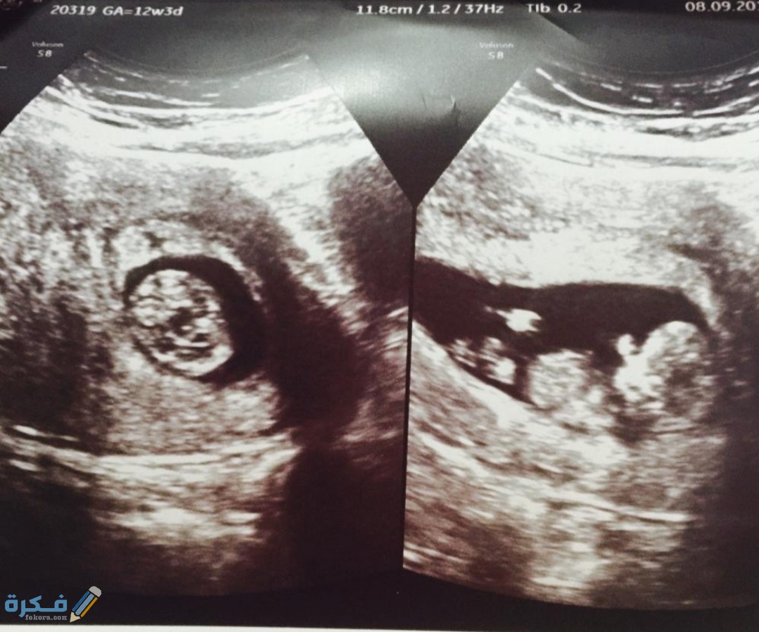 IMG ٢٠٢٠٠٤٢٦ ١٤٠٧٥٧