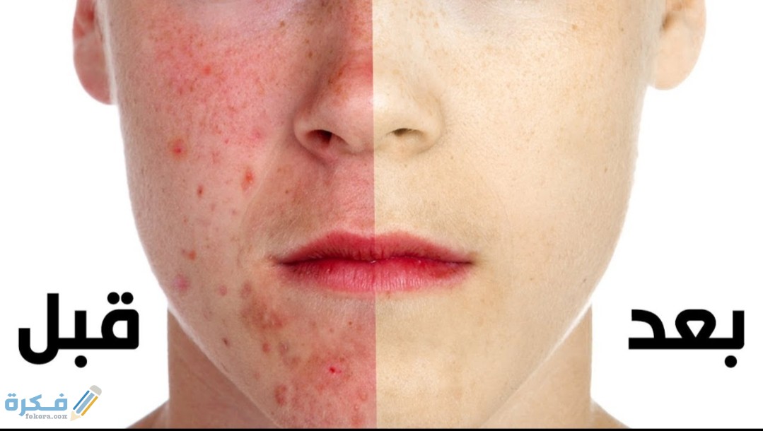 IMG ٢٠٢٠٠٥١٤ ١٤٣٣٥٣