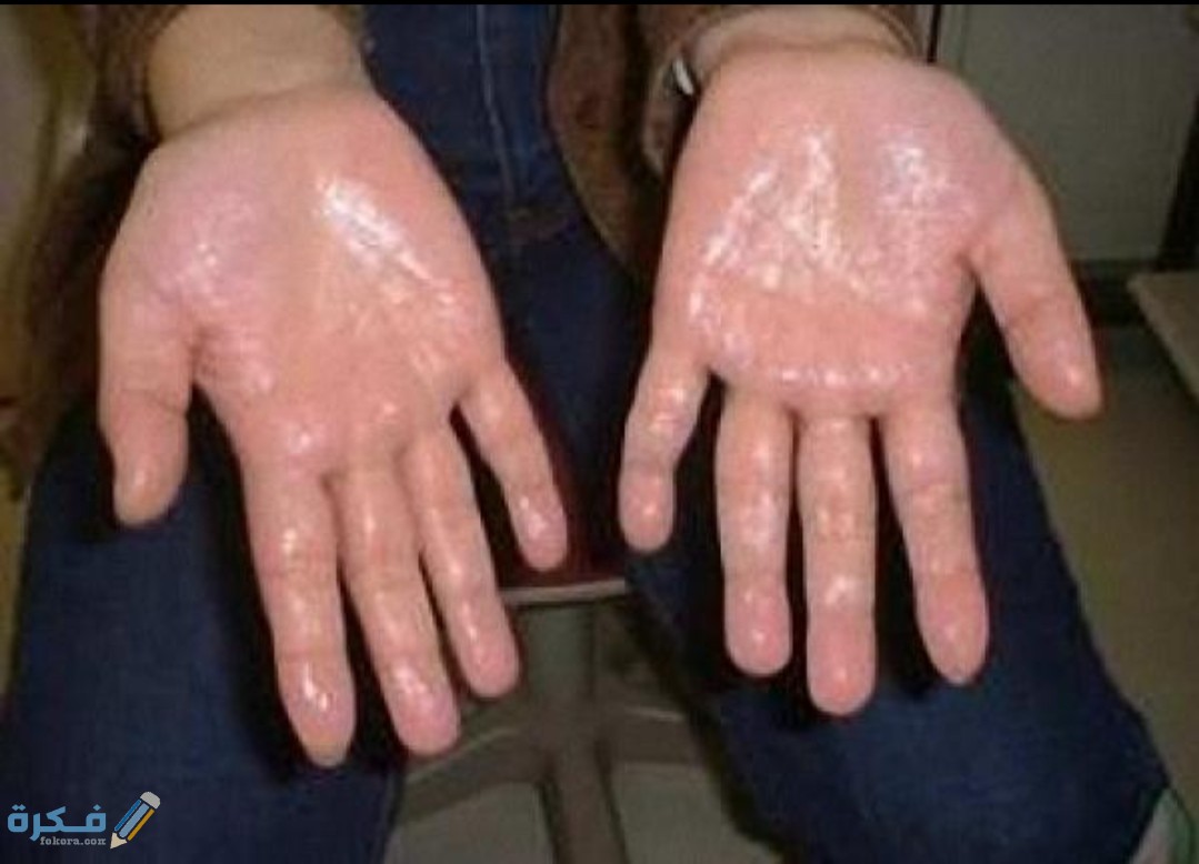 IMG ٢٠٢٠٠٨١٣ ١١٥٢٥٧