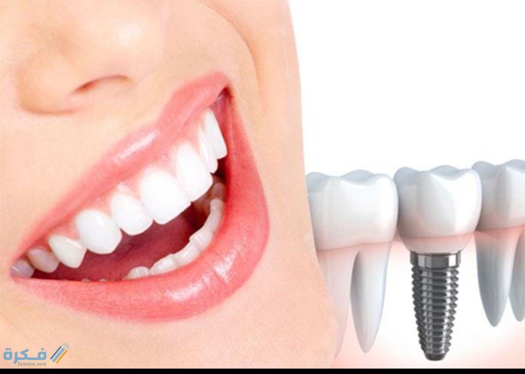 IMG ٢٠٢٠٠٨٢١ ١١٤٥٤٧