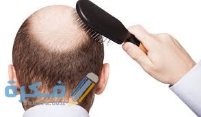 شعري يتساقط من جذوره بكثرة ما السبب و العلاج؟