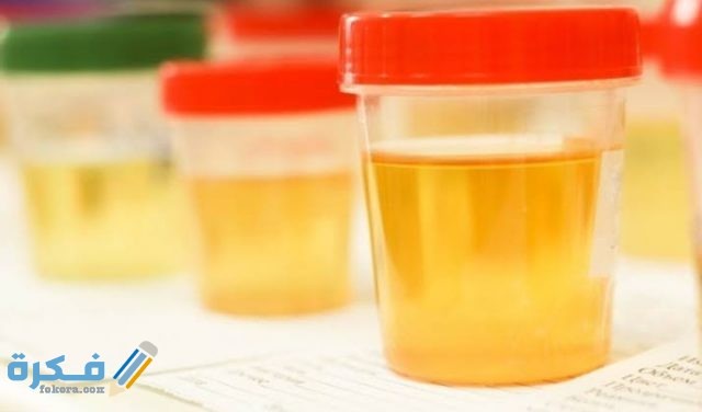 مدة صلاحية عينة البول للتحليل والطريقة الصحيحة لأخذ عينة