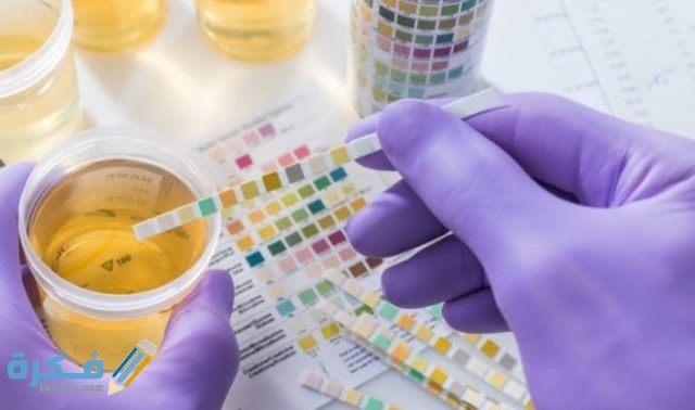 مدة صلاحية عينة البول للتحليل والطريقة الصحيحة لأخذ عينة