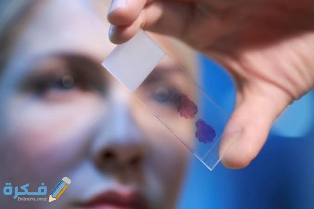 ما هي التحاليل التي تكشف سرطان الثدي