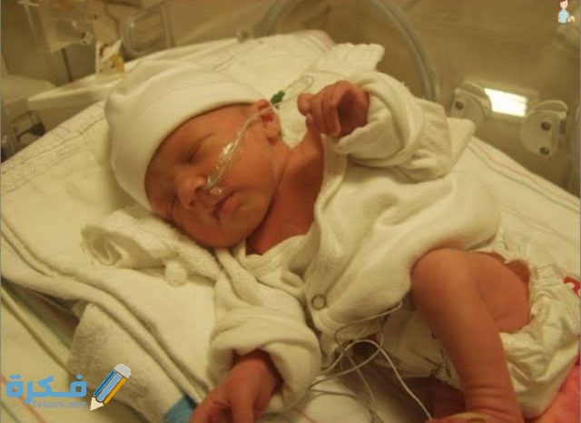 نسبة الصفراء 11 عند حديثي الولادة نسبة الصفراء 11 عند حديثي الولادة