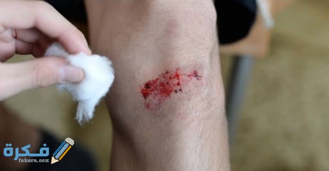 سبب بطء التئام الجروح والإسعافات الأولية اللازمة 2 أسباب بطء التئام الجروح والإسعافات الأولية اللازمة