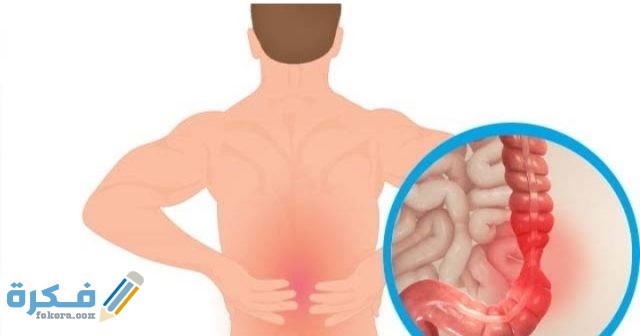 هَلْ القولون يسبب الم في اعلى الظهر؟ وأسباب الشعور بآلام الظهر هَلْ القولون يسبب الم في اعلى الظهر؟ وأسباب الشعور بآلام الظهر