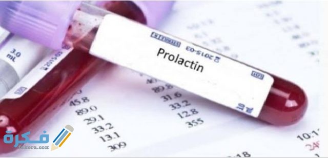 أسباب ارتفاع هرمون الحليب عند العذراء 