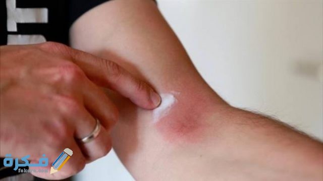 اسم أفضل مضاد حيوي لعلاج التهابات الجلد اسم أفضل مضاد حيوي لعلاج التهابات الجلد