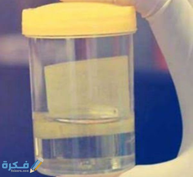 لون البول في الكيتو دايت والآثار السلبية لون البول في الكيتو دايت والآثار السلبية