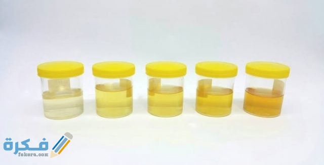 لون البول في الكيتو دايت والآثار السلبية لون البول في الكيتو دايت والآثار السلبية