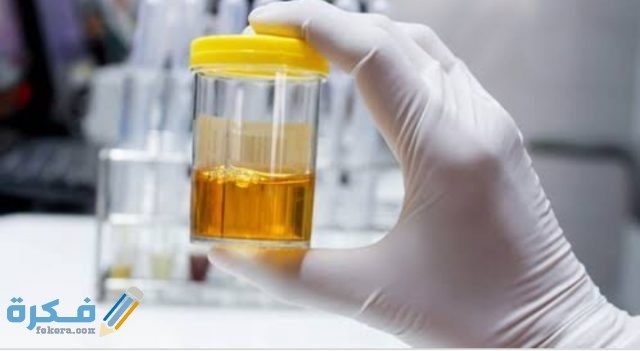 لون البول في الكيتو دايت والآثار السلبية لون البول في الكيتو دايت والآثار السلبية