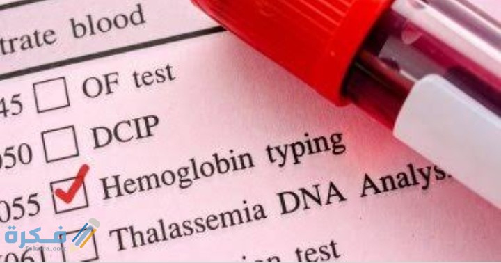 IMG ٢٠٢١٠٢١٧ ٠٠٠١٤٤