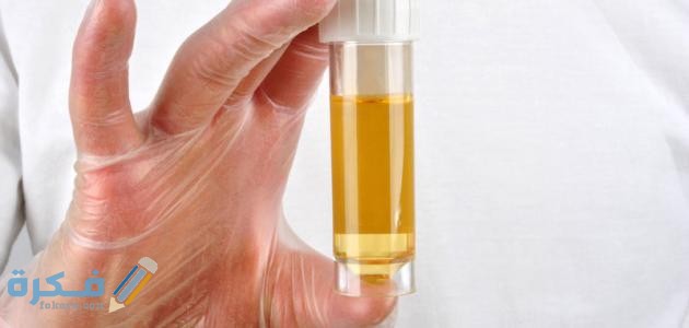 رموز تحليل البول pus cell ماذا تعني؟