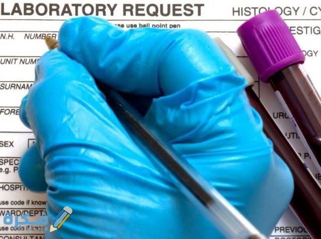 تحليل monocytes المعدل الطبيعي تحليل monocytes المعدل الطبيعي