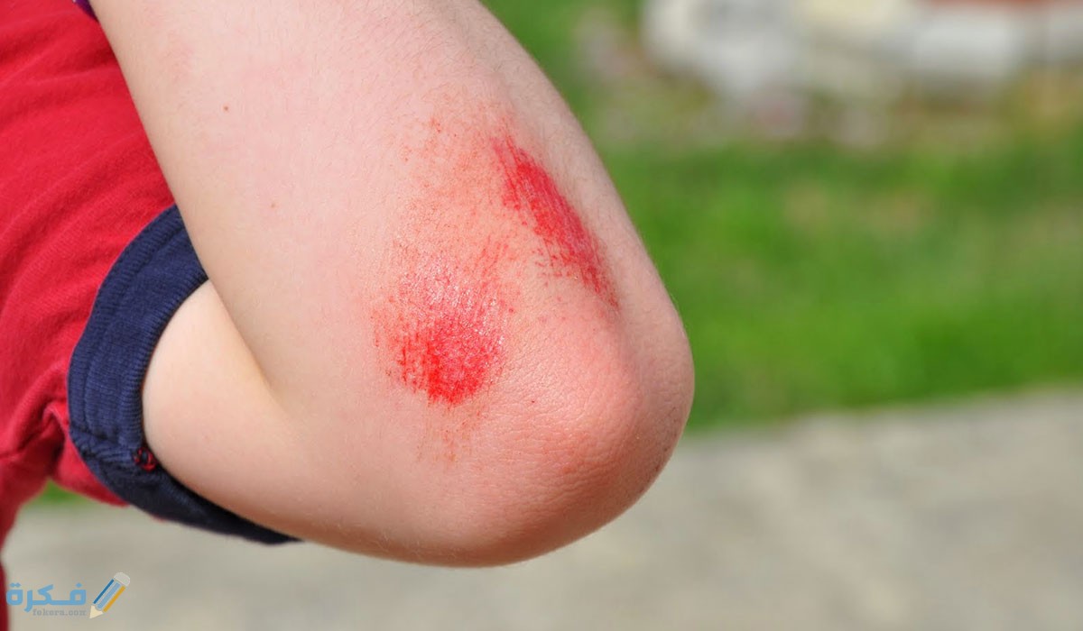 اسماء افضل مضاد حيوي رش للجروح الجرعة وطريقة الاستخدام