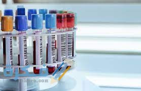 ما هو تحليل alkaline phosphatase ما هو تحليل alkaline phosphatase