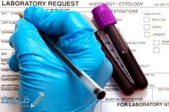 مفهوم تحليل ال wbc مفهوم تحليل ال wbc