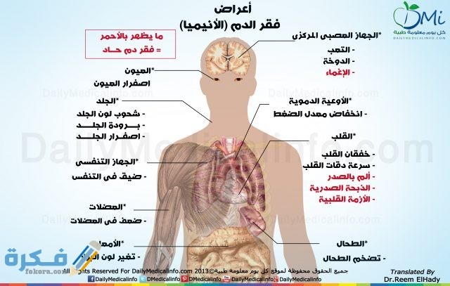 الأعراض العامة لفقر الدم الأعراض العامة لفقر الدم