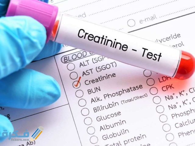 تحليل كرياتينين المصل تحليل كرياتينين المصل
