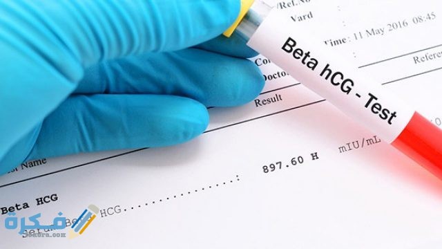 كيف أعرف أعراض الحمل في الشهر الثالث بولد طريقة قراءة تحليل البول للحامل