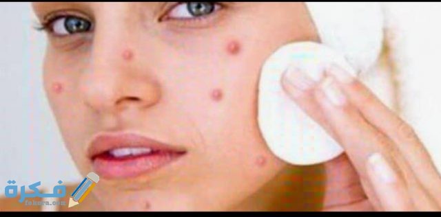 اسماء حبوب مضادات حيوية لعلاج حب الشباب 2 IMG ٢٠٢٠٠٥١٤ ١٤٣٤١٣