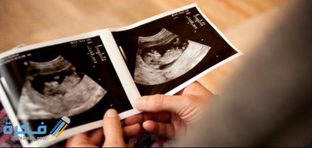 كيفية معرفة نوع الجنين من الشهر الاول IMG ٢٠٢٠٠٥١٤ ٢٣٠٤٣٧