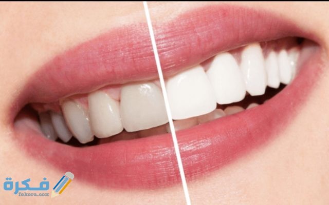 وصفة لتبيض الاسنان IMG ٢٠٢٠٠٥١٧ ١٥٠١٤٥