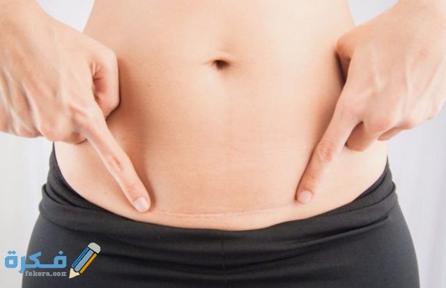 متى يشفي جرح القيصرية IMG ٢٠٢٠٠٥١٨ ٢٠٣٥٠٣