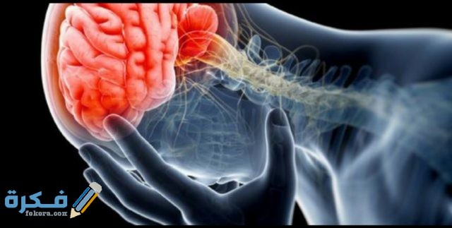 نزيف المخ IMG ٢٠٢٠٠٥٢٠ ١٣٤٩٢٢