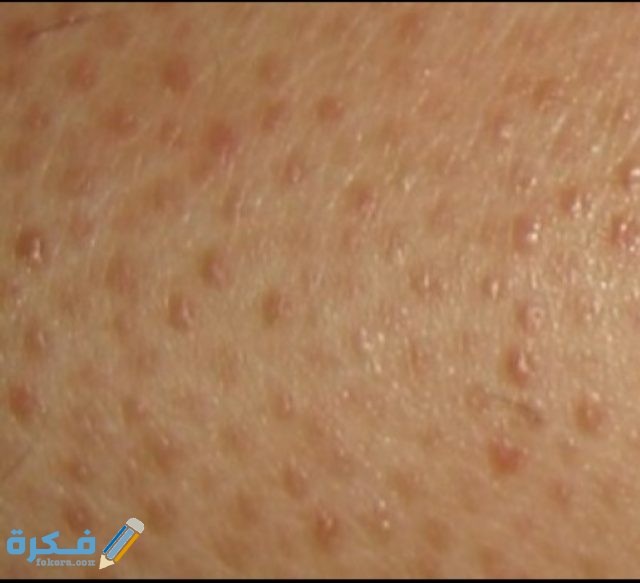 IMG ٢٠٢٠٠٥٢١ ٢٠٥٧٥٤