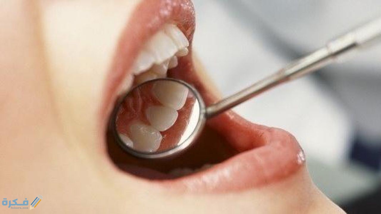 اسباب ظهور خراج الاسنان