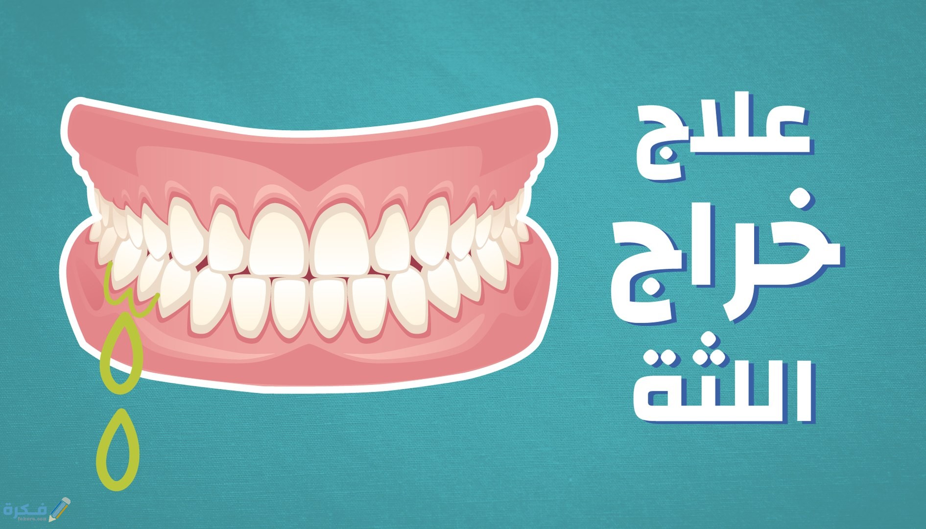 نصائح للتخفيف من الم الخراج