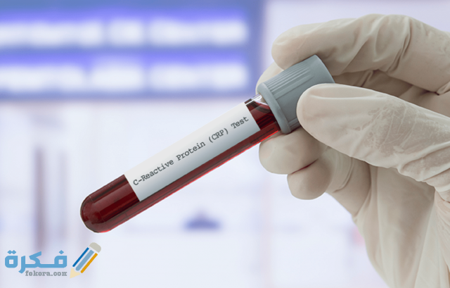 أسعار تحليل crp أسعار تحليل crp