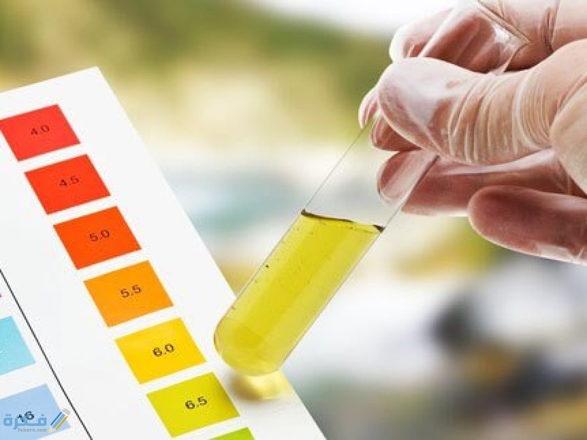 تحليل-البول-للحامل