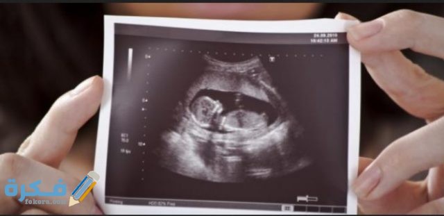 الحامل والجنين في الشهر الثاني من الحمل IMG ٢٠٢٠٠٨٠٢ ١٣١١١٣