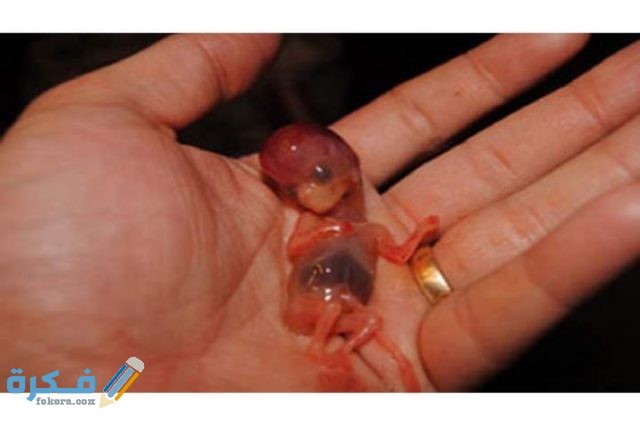 أسباب تأخر الحمل بعد الاجهاض IMG ٢٠٢٠٠٨٠٢ ١٣٣٧١٣