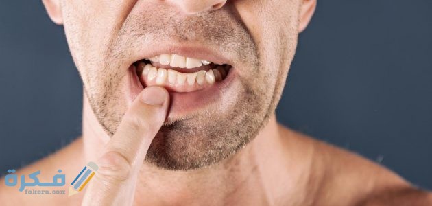 ادوية علاج التهاب اللثة والاسنان علاج التهاب اللثة والاسنان 630x300 1