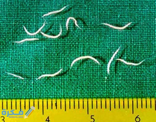 أفضل دواء لعلاج الديدان الدبوسية أفضل دواء لعلاج الديدان الدبوسية