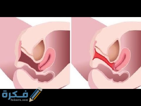 DD400C08 0C1F 4F38 81A6 A1229C0B4B32