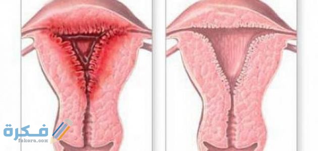 اسباب رائحة المهبل الكريهة مثل السمك اسباب رائحة المهبل الكريهة مثل السمك