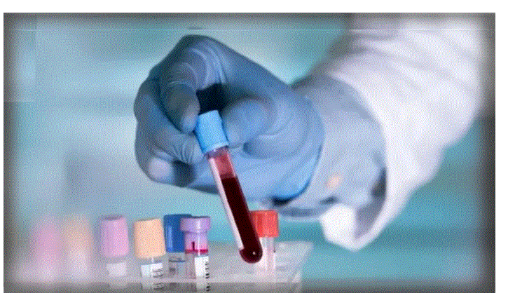 معلومات عن تحليل anti cardiolipin