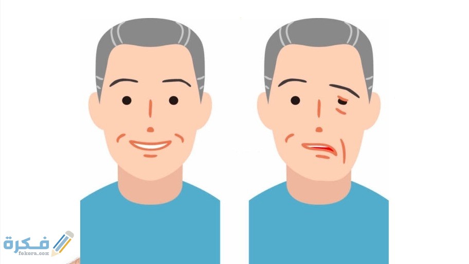 روشتة علاج التهابات العصب السابع روشتة علاج التهابات العصب السابع