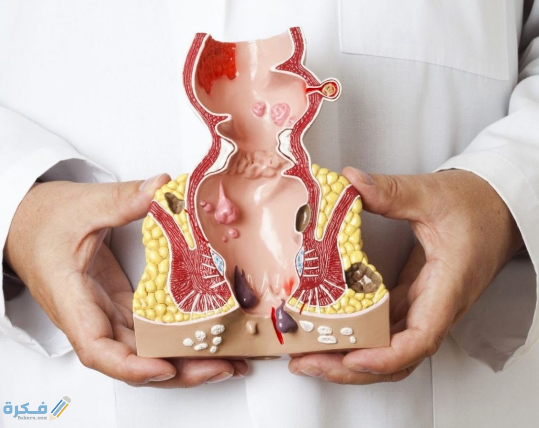 هل البواسير تسبب خروج دم مع البراز ؟