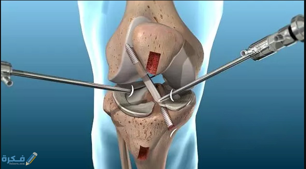 مفهوم الرباط الصليبي