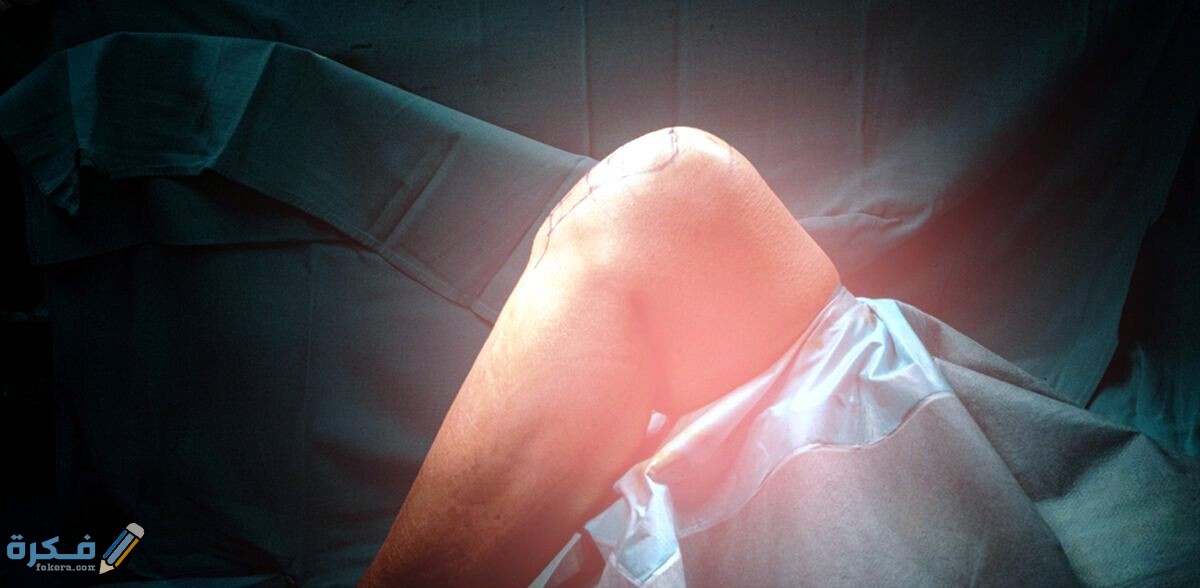 اجراءات ما قبل عملية الغضروف