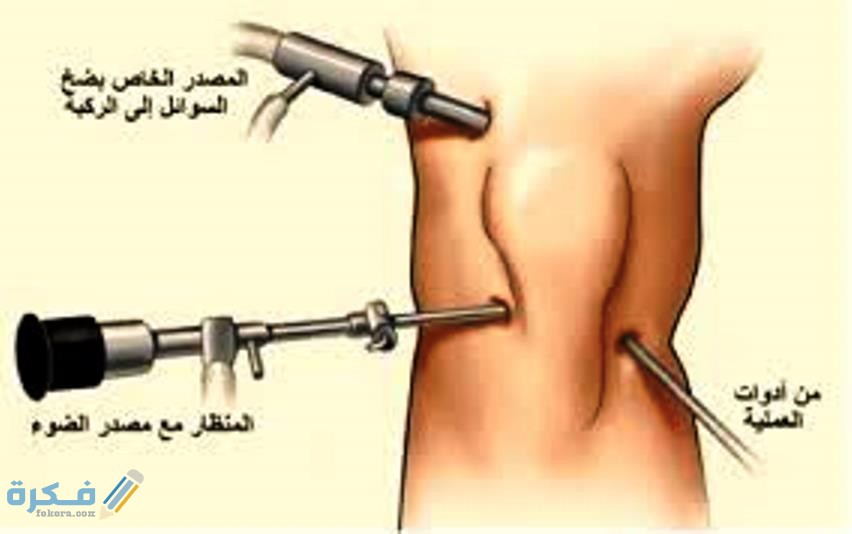 كم تكلفة عملية الرباط الصليبي 4 الاسعافات الاولية للرباط الصليبي
